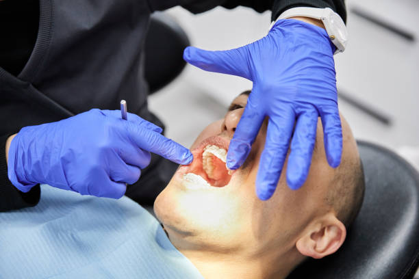 Best Emergency Dentist for Knocked-Out Tooth in Oswego, KS